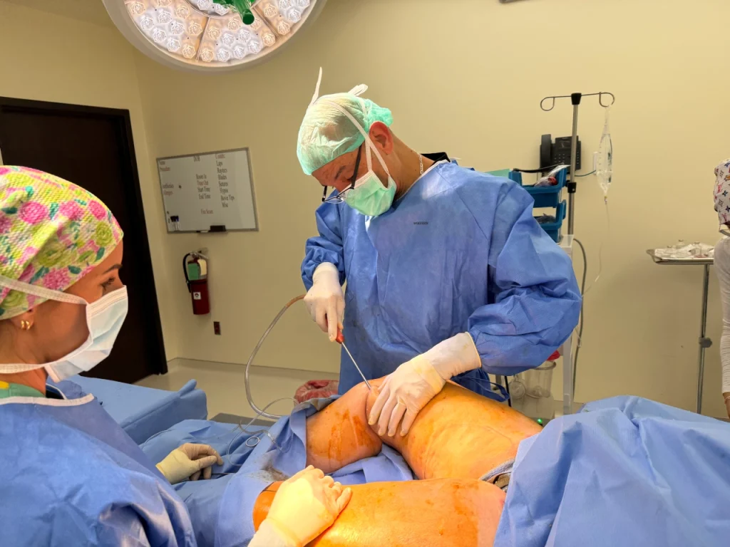 Thigh Sculpturing